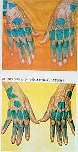 Фото 5.3. Пример традиционной женской татуировки (главный остров Окинава. - фото из 